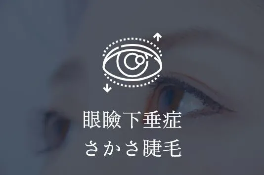 眼瞼下垂症さかさ睫毛